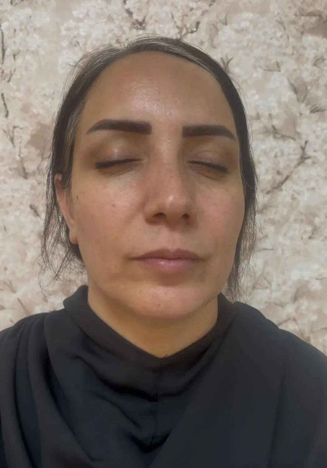 فیلر بوتاکس جوانساز جراحی بادی نخ مزو هیرفیلر|خدمات آرایشگری و زیبایی|تهران, پاسداران|دیوار