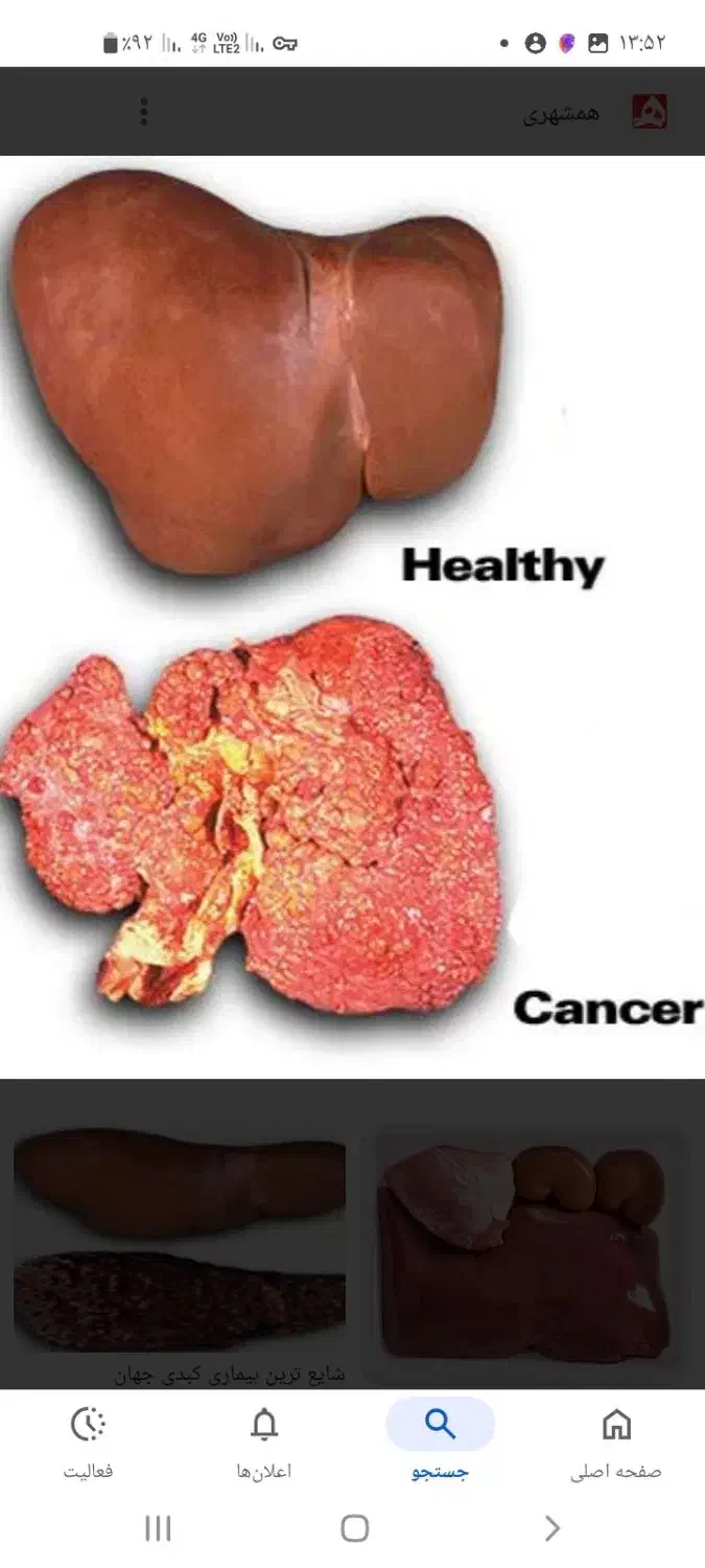 تهیه اعضای گاو و یا گوسفند برای تشریح و مطالعه|خدمات آموزشی|گناباد, |دیوار