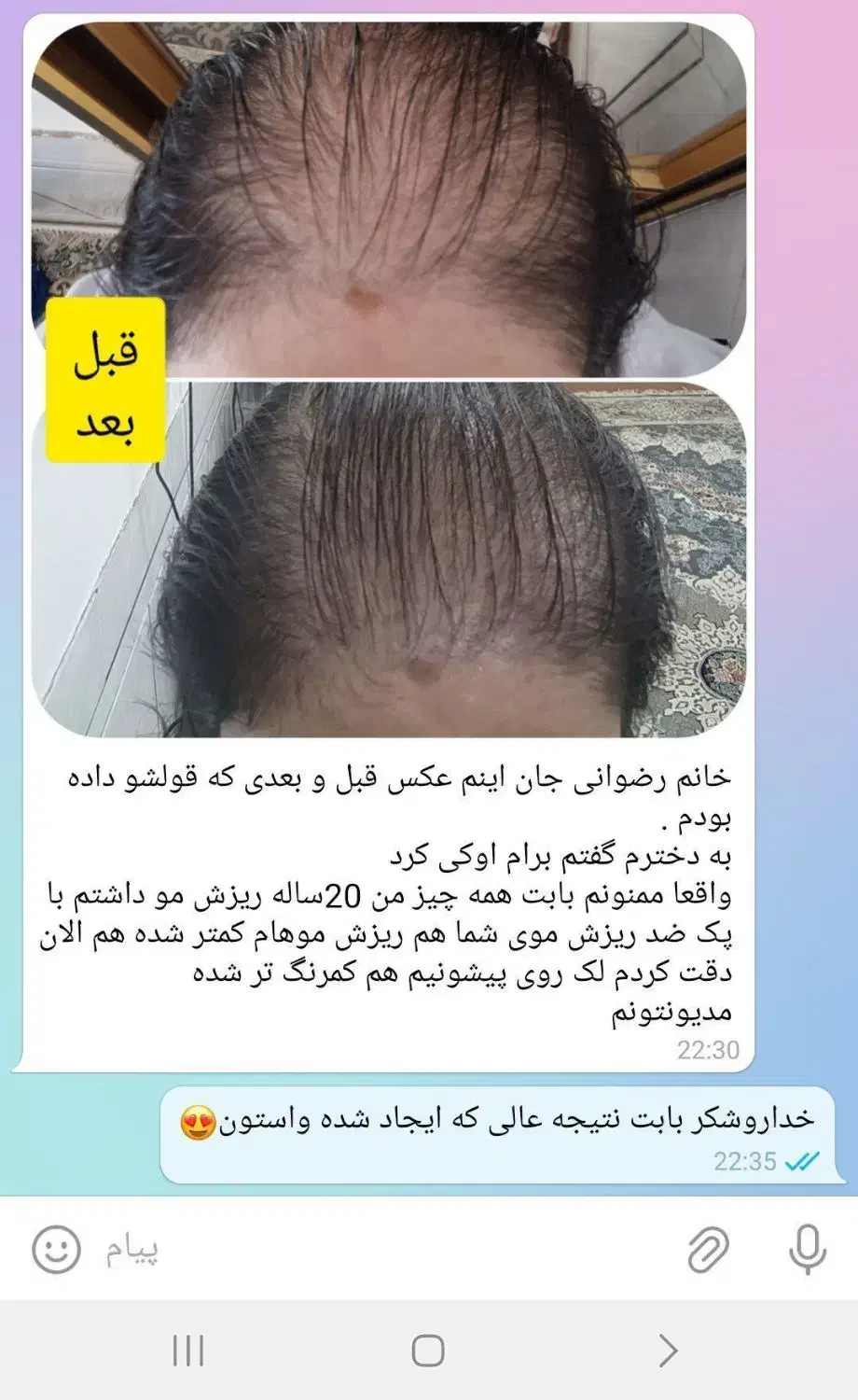 با تونیک ضدریزش آریا موهای ریختتو برگردون|آرایشی، بهداشتی، درمانی|کرمان, |دیوار