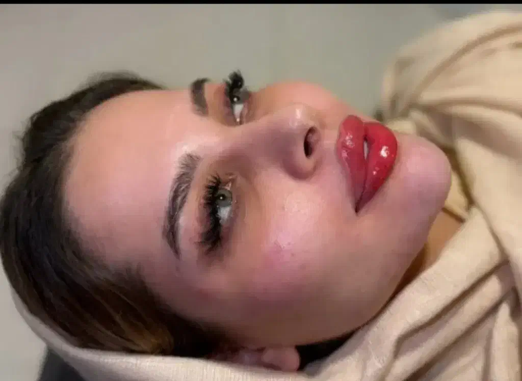 جشنواره  یلدایی تزریق ژل فقط و فقط هر سیسی ۱ ملیون|خدمات آرایشگری و زیبایی|همدان, |دیوار