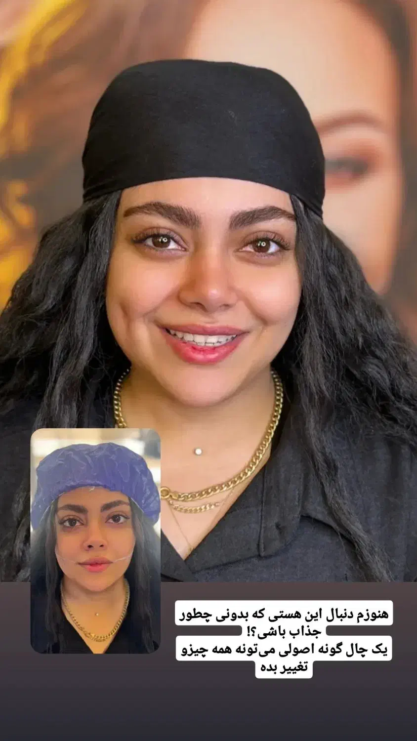 چال گونه دائم|خدمات آرایشگری و زیبایی|زاهدان, |دیوار