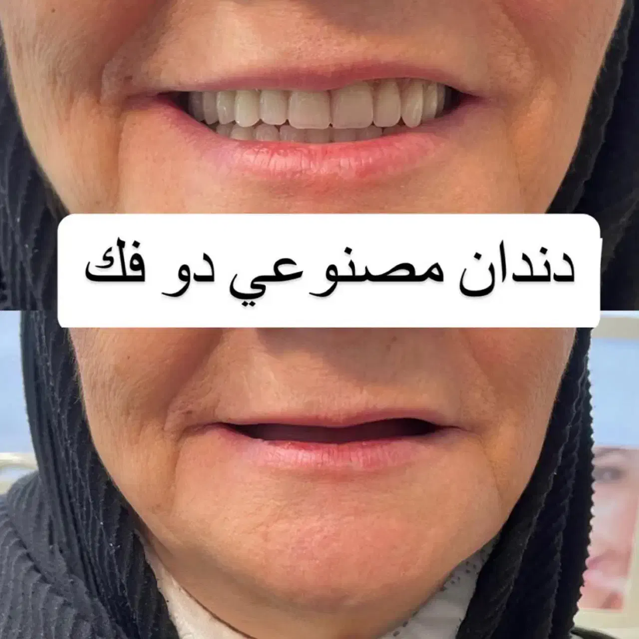 ساخت و تعمیر دندان مصنوعی/مواد آلمانی/نقد و اقساط|خدمات آرایشگری و زیبایی|چناران, |دیوار