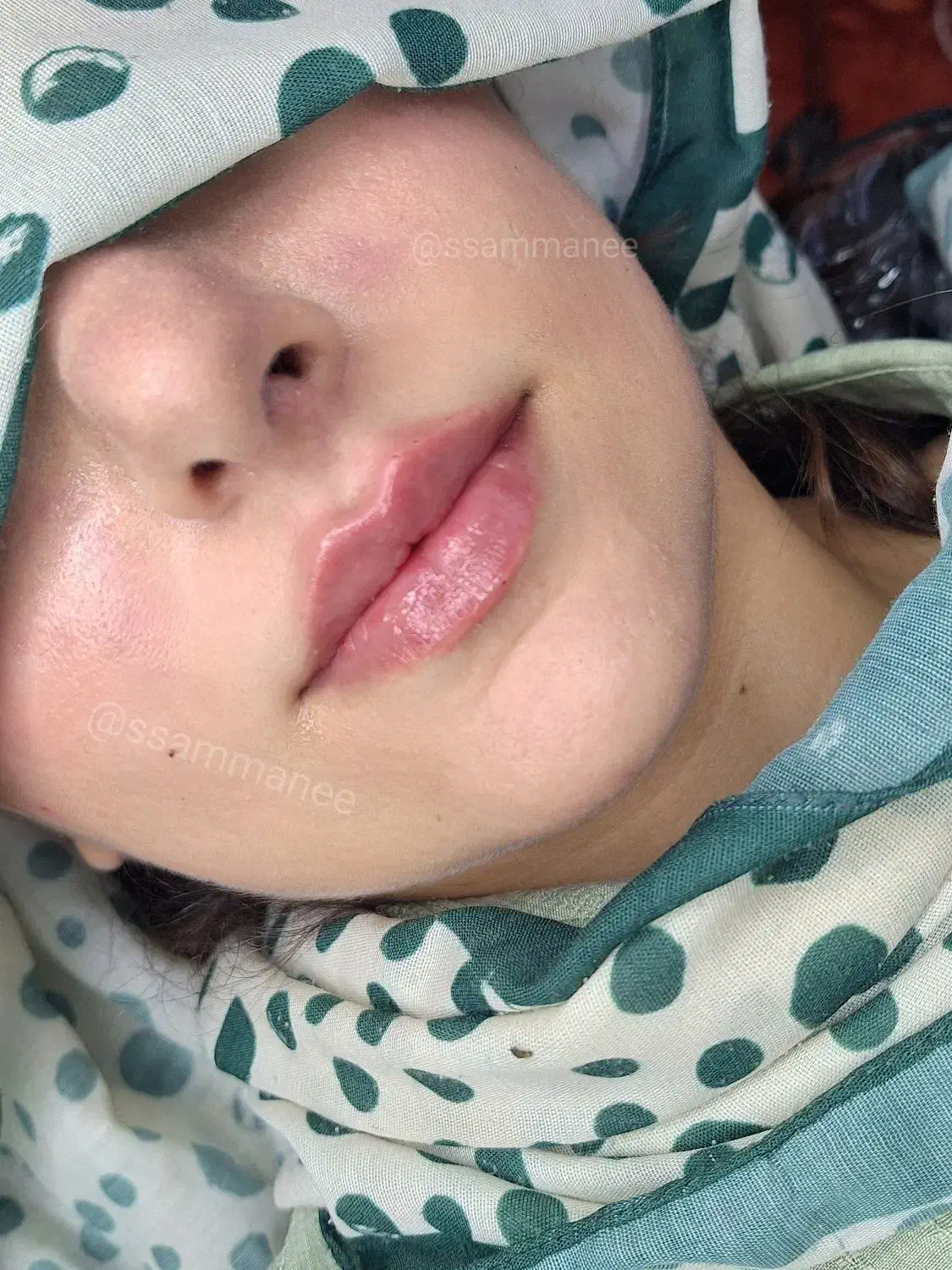 ژل بوتاکس فیلر ،خالبرداری، آموزش فیشیال وپاکسازی|خدمات آرایشگری و زیبایی|شیراز, منطقه هوایی شهید دوران|دیوار