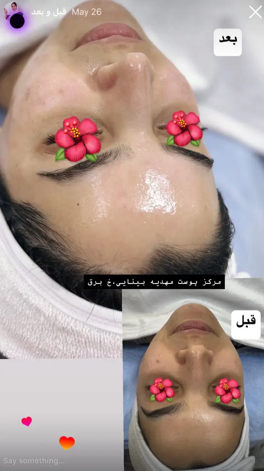 فیشال تخصصی و درمانی با برند کلینیکی کره جنوبی|خدمات آرایشگری و زیبایی|بندر کنگان, |دیوار