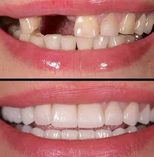 مرکز تخصصی دندانپزشکی ایمپلنت شرایط ویژه اقساطی|خدمات آرایشگری و زیبایی|تبریز, |دیوار