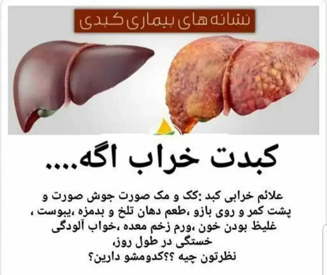 پاکسازی و کنترل کبد چرب|خدمات آرایشگری و زیبایی|سمیرم, |دیوار