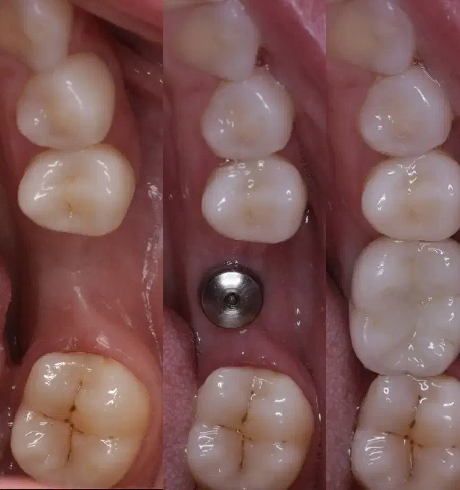 خدمات دندانپزشکی تخصصی کلینیک دی با اقساط بلند مدت|خدمات آرایشگری و زیبایی|پارسآباد, |دیوار