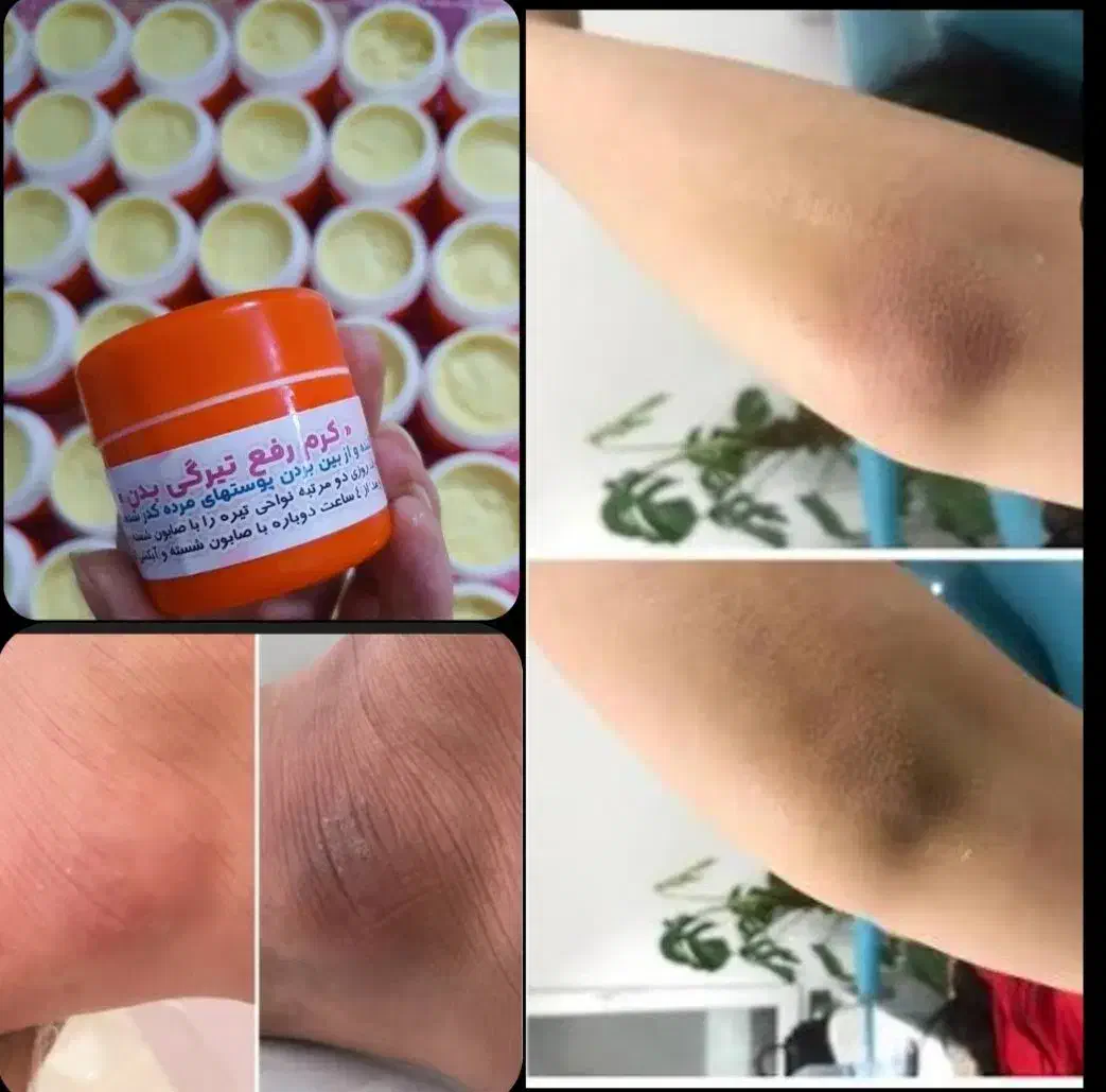 کرم معجزه ،کرم تیرگی بدن، ژل تقویت ابرو|آرایشی، بهداشتی، درمانی|آستارا, |دیوار