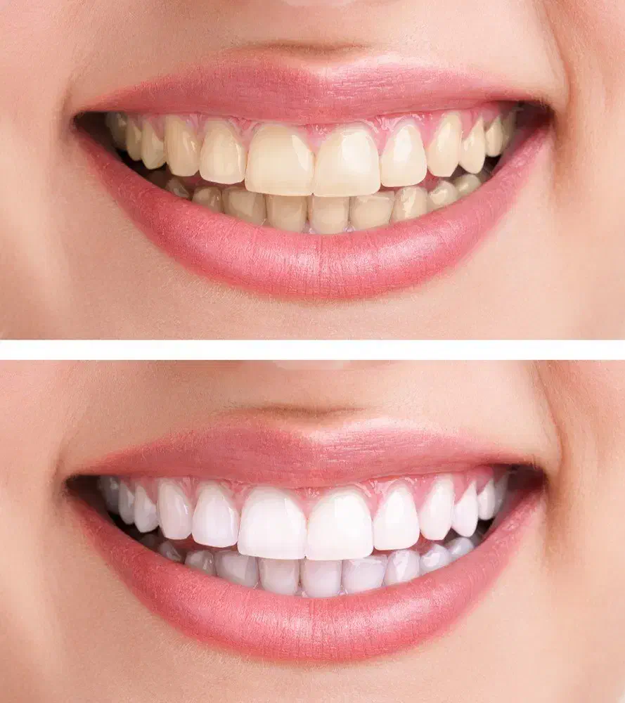 دندانپزشک قسطی بدون پیش پرداخت کلیه خدمات|خدمات آرایشگری و زیبایی|اصفهان, دشتستان|دیوار