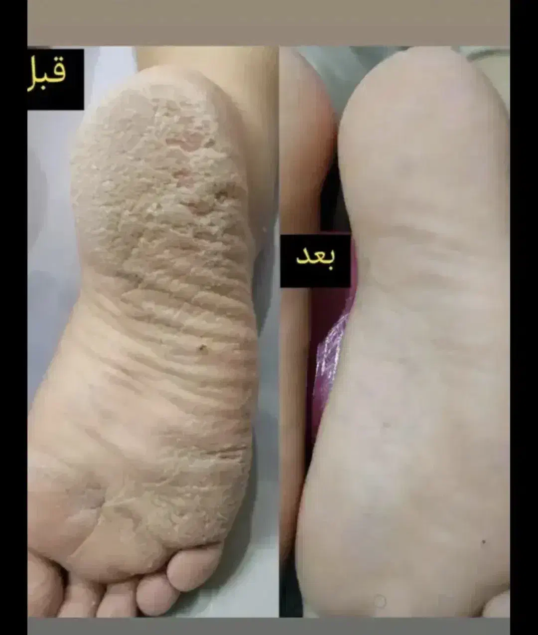 پدیکور درمانی مانیکور پارافین دست وپا|خدمات آرایشگری و زیبایی|کارون, |دیوار