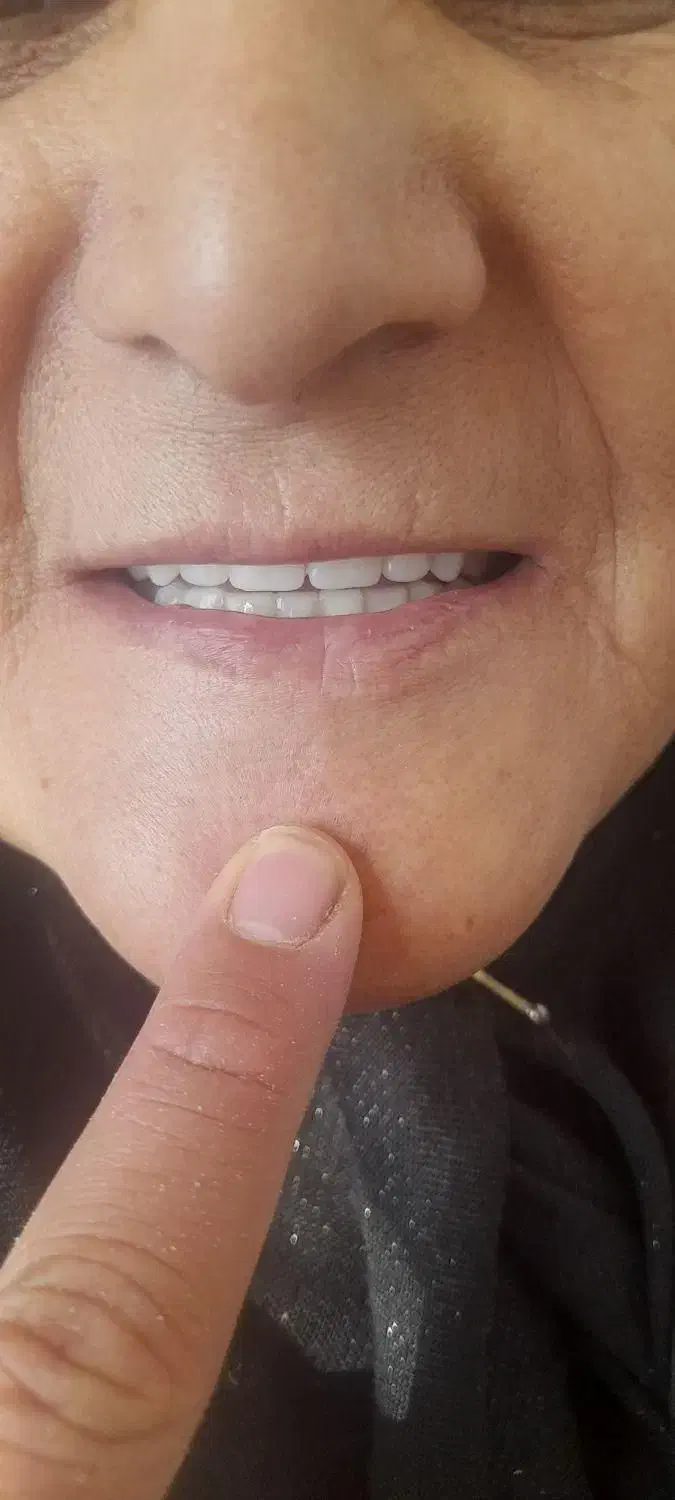 ندانسازی ۲۰درصدتخفیف|خدمات آرایشگری و زیبایی|تربت‌حیدریه, باغ ملی|دیوار