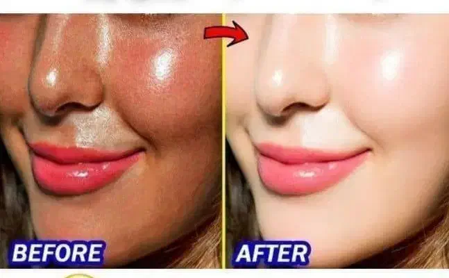 کرم سفید کننده صورت  بدن 10درجه سفیدی بدون بازگشت|آرایشی، بهداشتی، درمانی|زابل, |دیوار