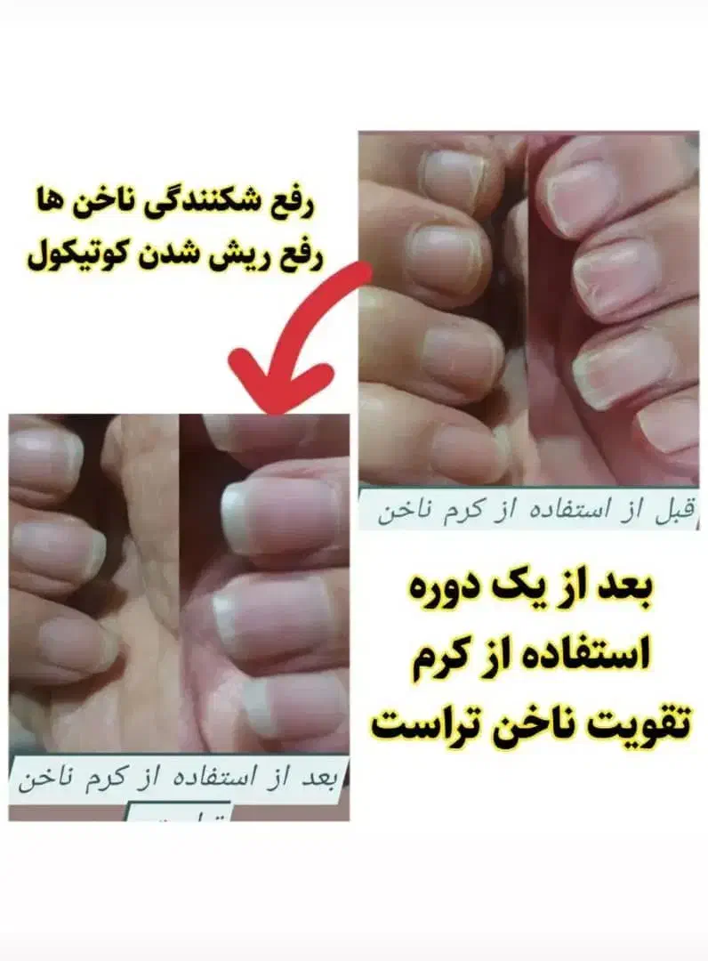 مشاوره درمانی|خدمات آرایشگری و زیبایی|شیراز, حافظیه|دیوار