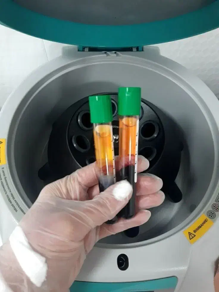 خدمات زیبایی بوتاکس مزو لیزربانوان اقایان فیشال|خدمات آرایشگری و زیبایی|بیرجند, |دیوار