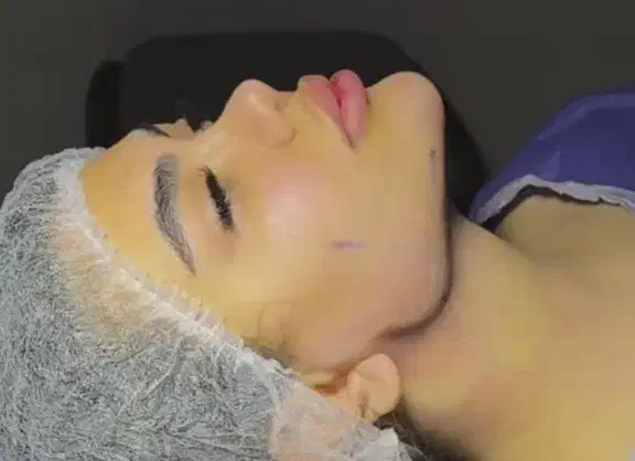 لیپو سوپر کانتور غبغب|خدمات آرایشگری و زیبایی|کرج, کوی ایثار|دیوار