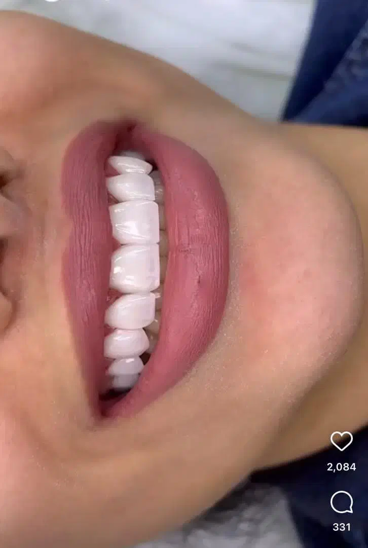 اموزش دندان سازی .ثابت ومتحرک وکامپوزیت|خدمات آرایشگری و زیبایی|شیراز, وصال|دیوار