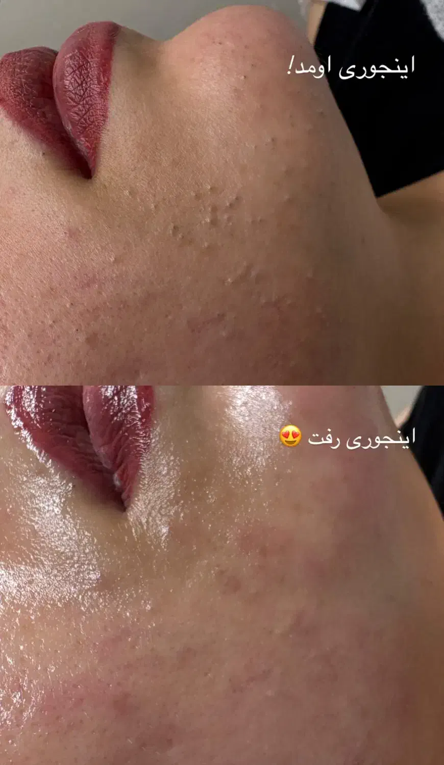 پاکسازی و فیشیال پوست|خدمات آرایشگری و زیبایی|مسجد سلیمان, |دیوار