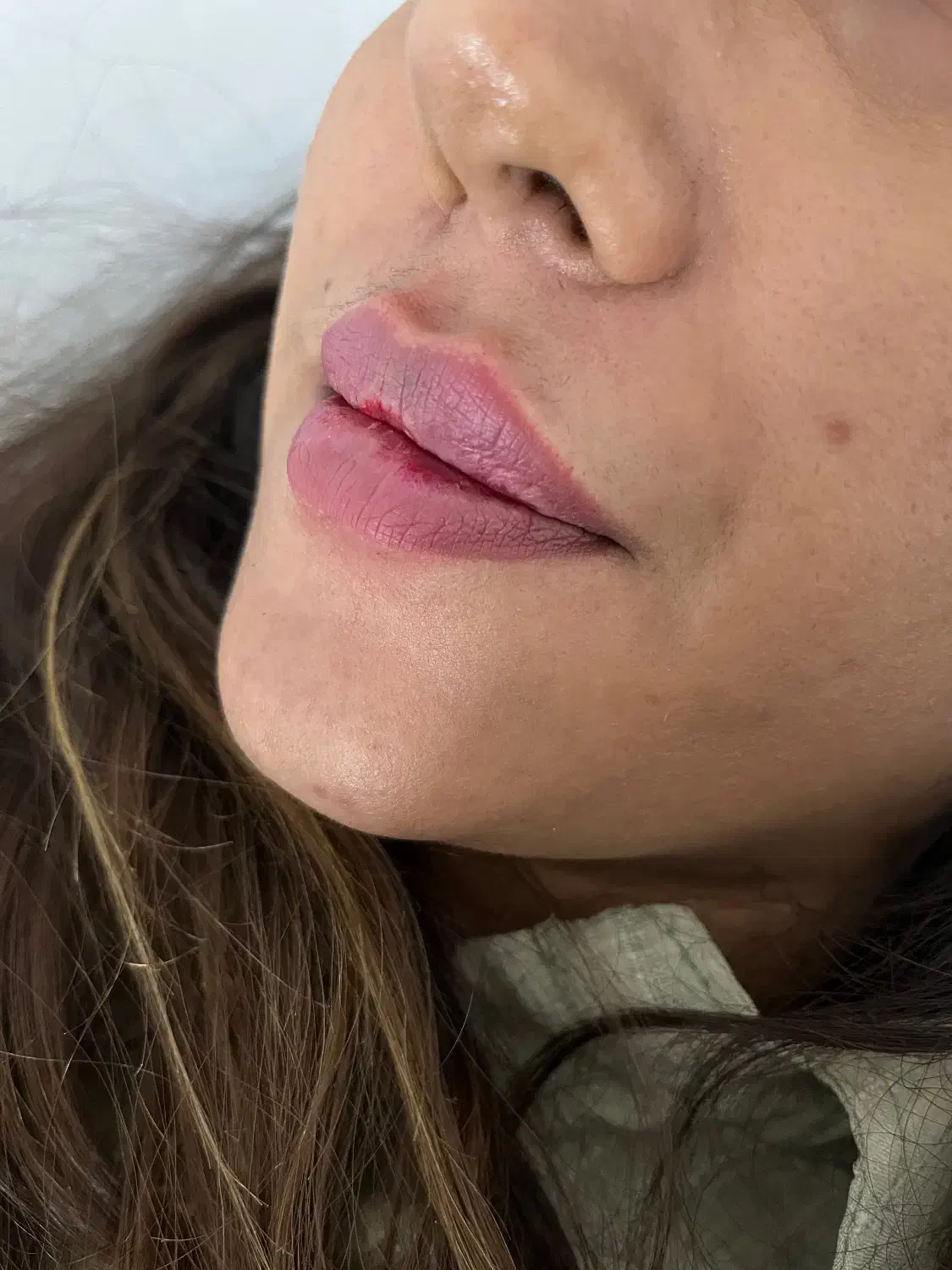 تزریق ژل|خدمات آرایشگری و زیبایی|بم, |دیوار