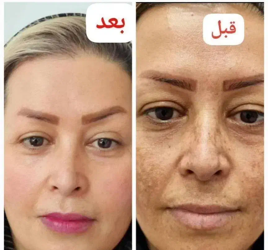 روغن های محصولات گیاهی|آرایشی، بهداشتی، درمانی|کوهدشت, |دیوار