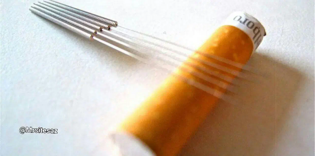 ترک سیگار و هرگونه اعتیاد با طب سوزنی|خدمات آرایشگری و زیبایی|کرمانشاه, |دیوار