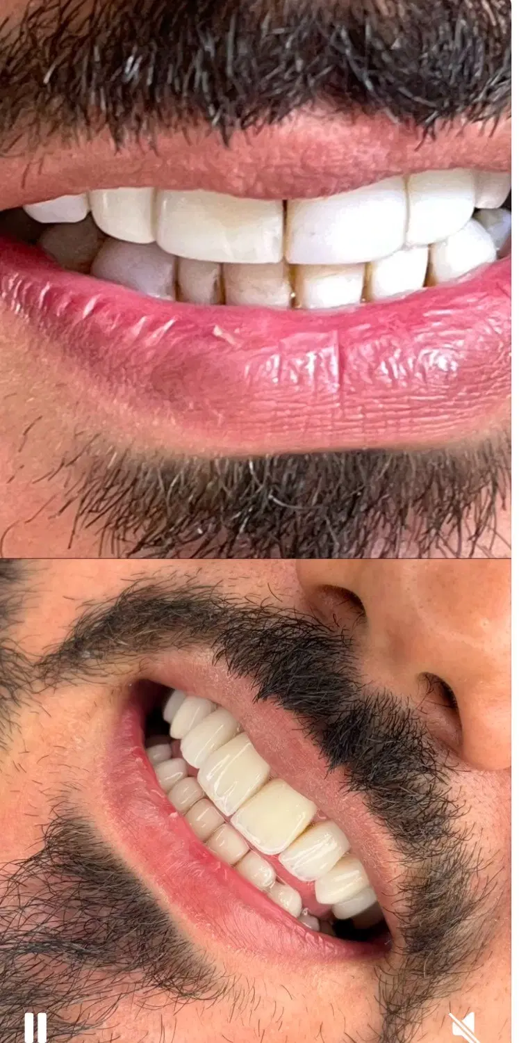 خدمات دندانپزشکی با  اقساط بدون پیش پرداخت|خدمات آرایشگری و زیبایی|تهران, تهرانپارس غربی|دیوار