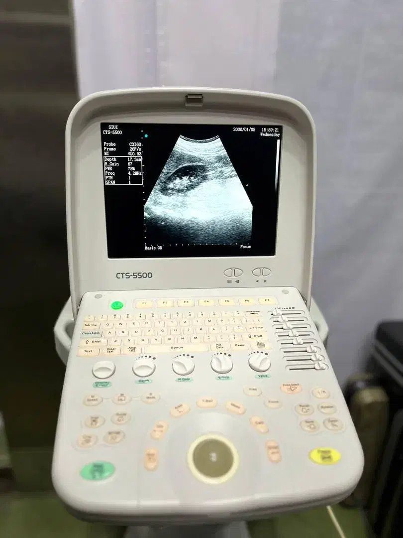 سونوگرافی siui|پزشکی|تهران, جمهوری|دیوار