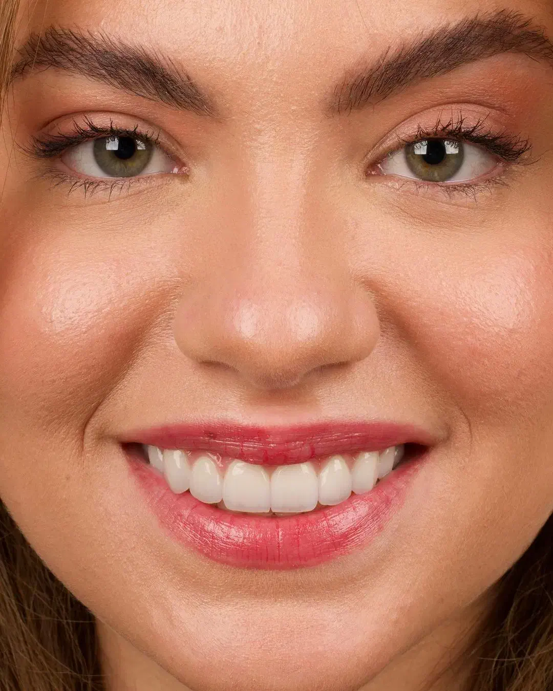 دستیار دندانپزشک|استخدام درمانی، زیبایی، بهداشتی|تهران, نیاوران|دیوار