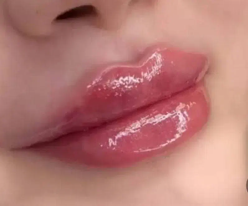 چربی شکم بلفارو|خدمات آرایشگری و زیبایی|حمیدیه, |دیوار