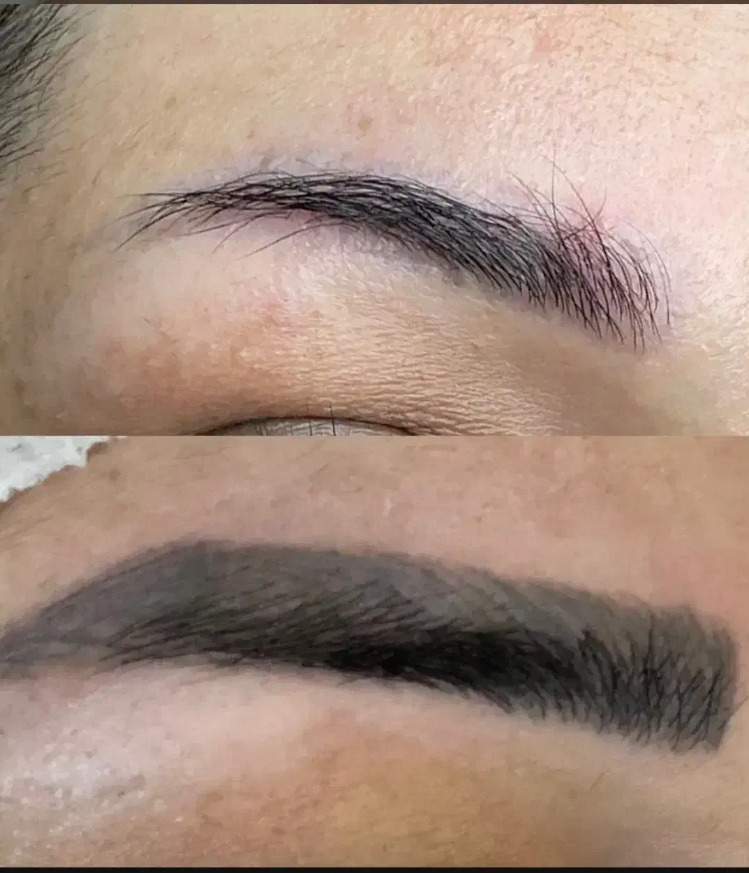 ریموو تاتو تک جلسه ای|خدمات آرایشگری و زیبایی|تربتحیدریه, طالقانی|دیوار