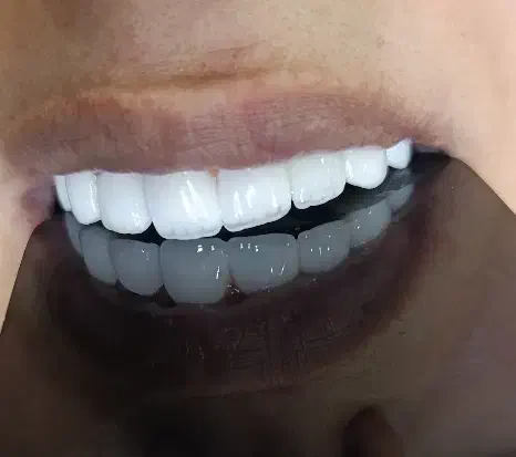 دندانپزشکی بیمه تامین اجتماعی کمیته امدادوبهزیستی|خدمات آرایشگری و زیبایی|نورآباد, |دیوار