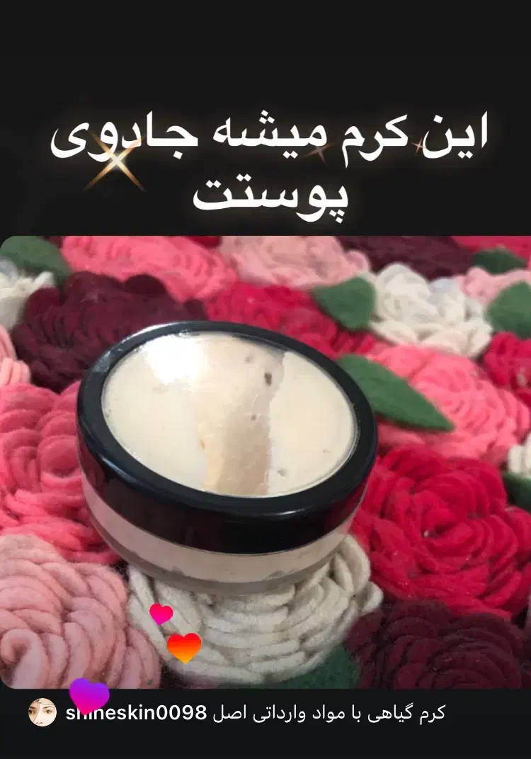 کرم ضدلک و سفیدکننده قوی و‌جوانساز صورت|آرایشی، بهداشتی، درمانی|فردیس, مجموعه کارخانه جات مپنا|دیوار