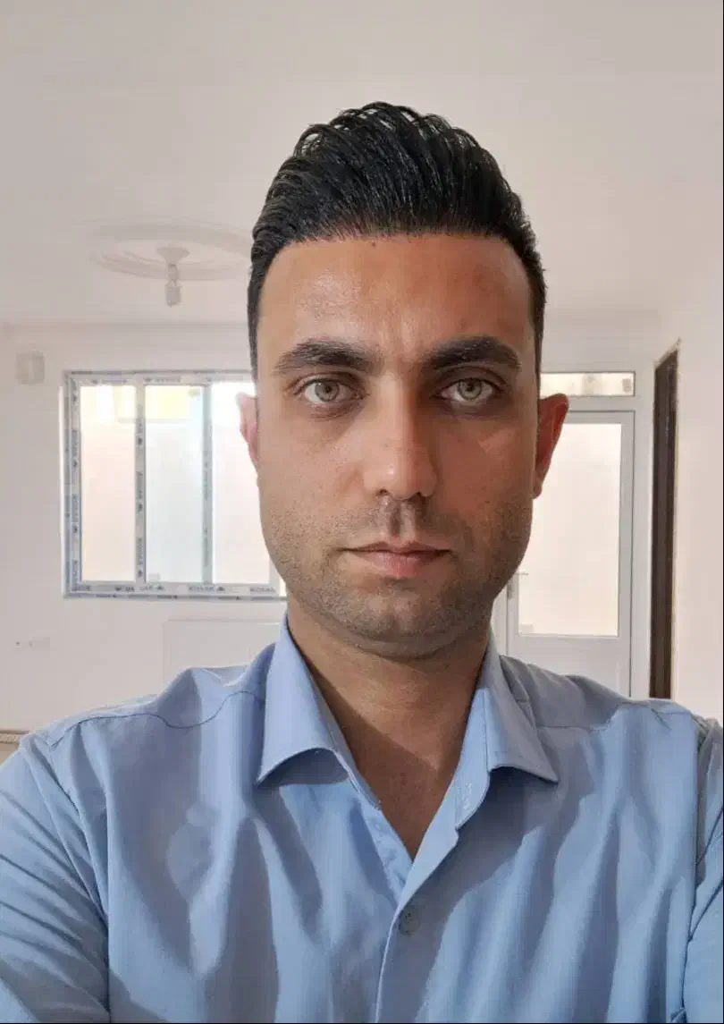 کاشت مو ابرو به بروز ترین با شرایط پرداخت اقساطی|خدمات آرایشگری و زیبایی|تبریز, |دیوار