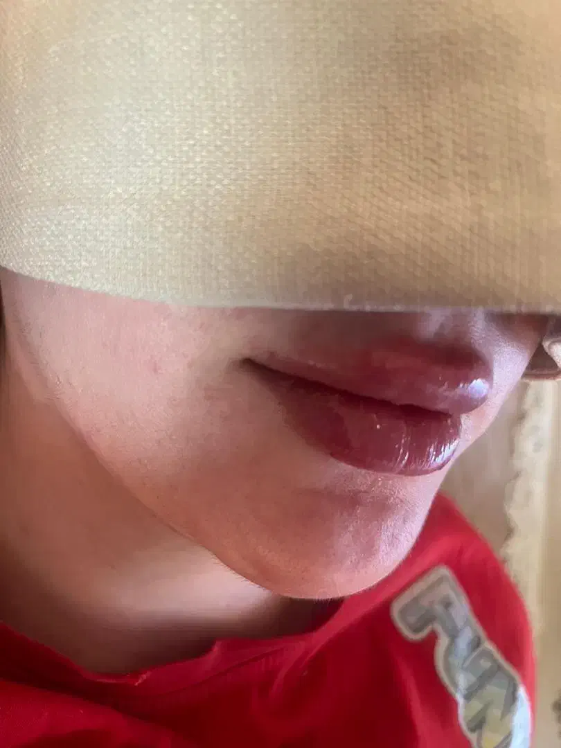 فیلر هر برندی مشتری بخواد|خدمات آرایشگری و زیبایی|یاسوج, |دیوار