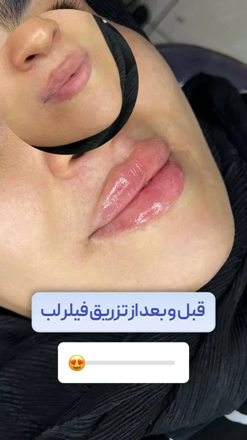 خدمات زیبایی|خدمات آرایشگری و زیبایی|شیراز, منطقه هوایی شهید دوران|دیوار