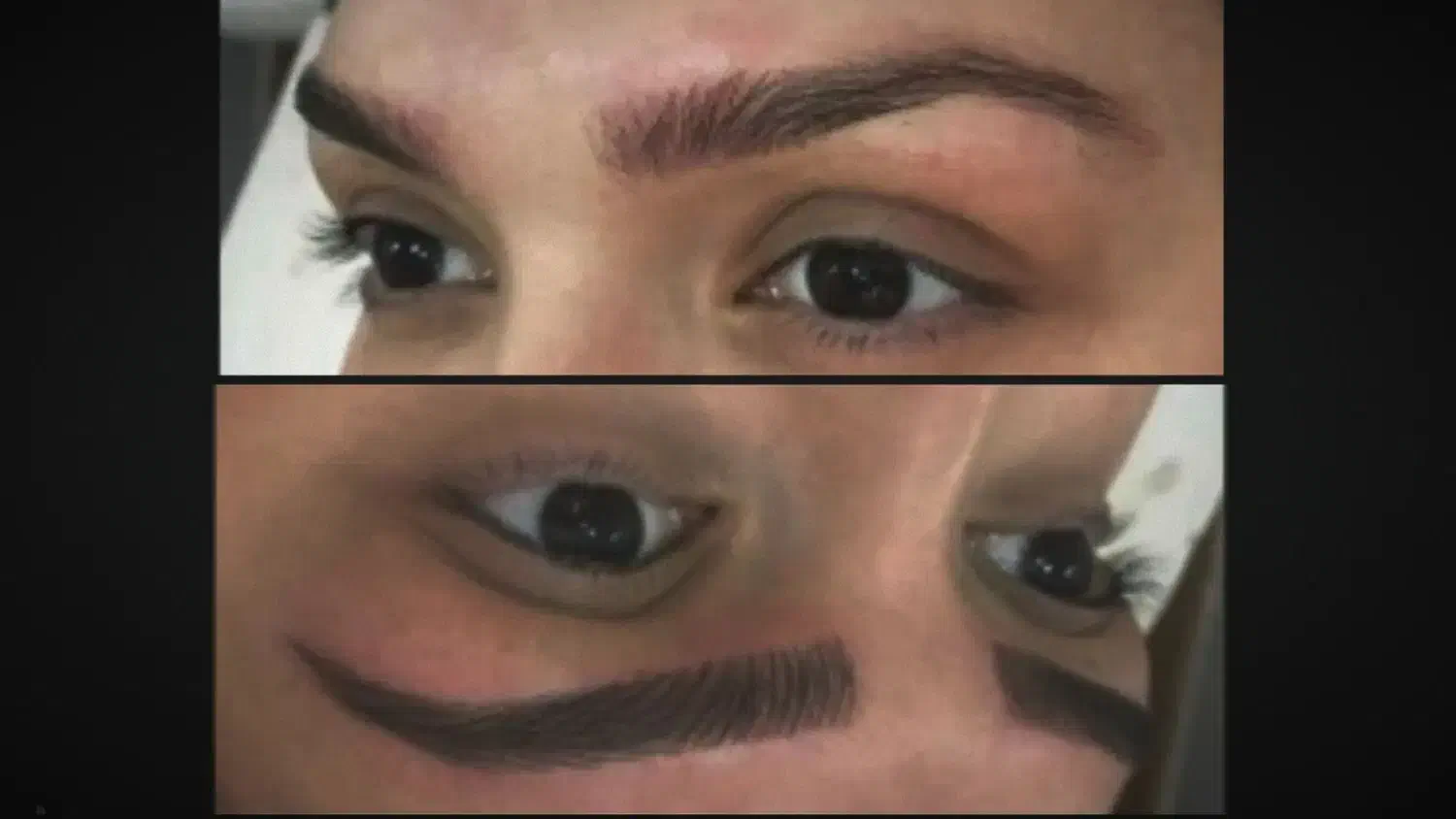 مدل میکروبلیدینگ فیبروز کاورتاتوقدیمی نانوبروز|خدمات آرایشگری و زیبایی|ری, اقدسیه|دیوار