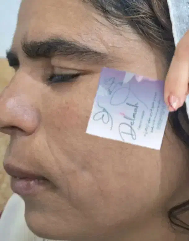 برداشتن لک و کک و مک|خدمات آرایشگری و زیبایی|نورآباد, |دیوار