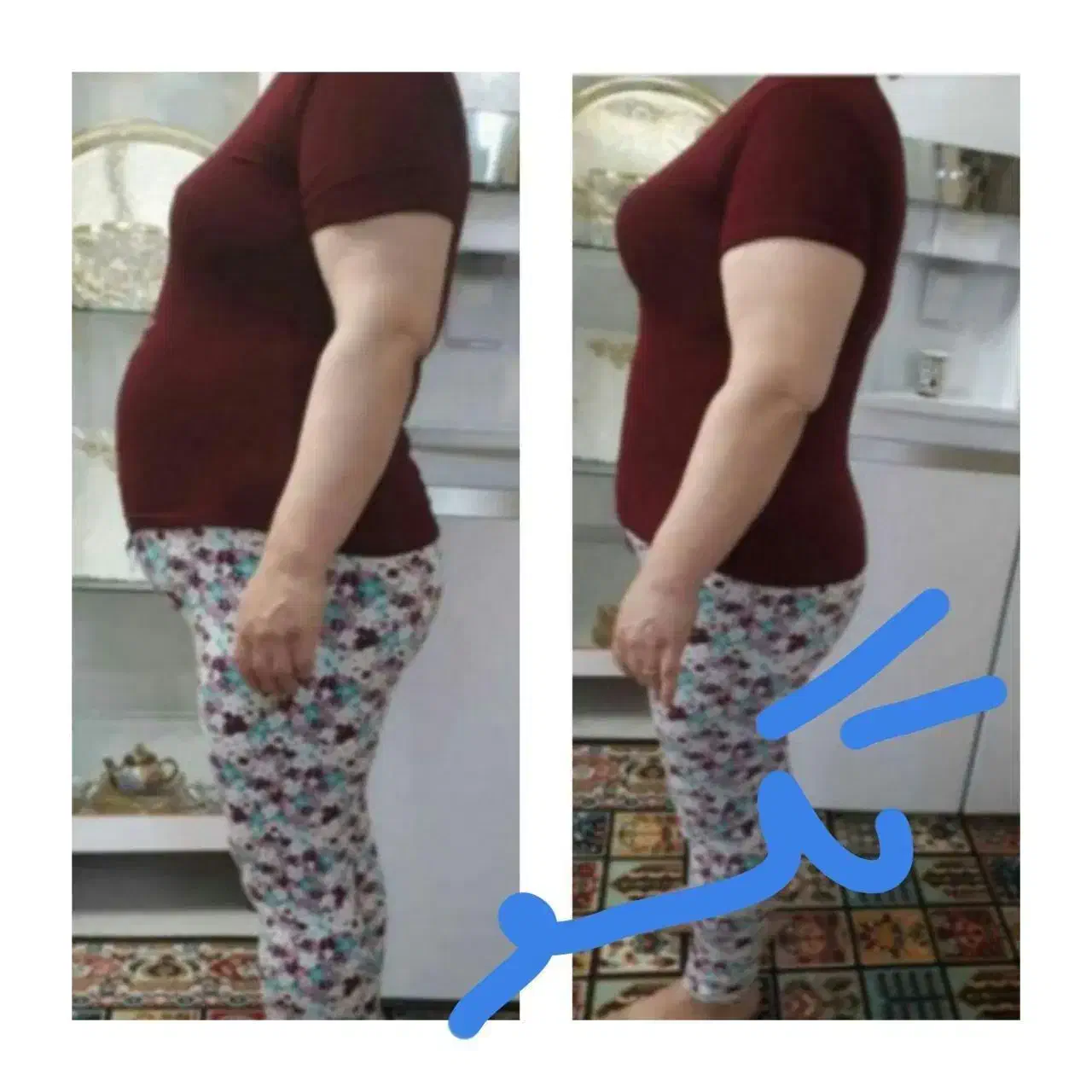 کاهش سایز وچربی سوزی|آرایشی، بهداشتی، درمانی|تربت‌حیدریه, کلاته توکلی|دیوار