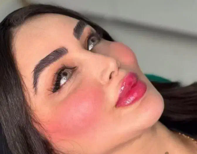فیلر ژل لب بوتاکس تخصصی پزشک کلینیک تهرانسر|خدمات آرایشگری و زیبایی|اسلام‌شهر, باغ فیض|دیوار