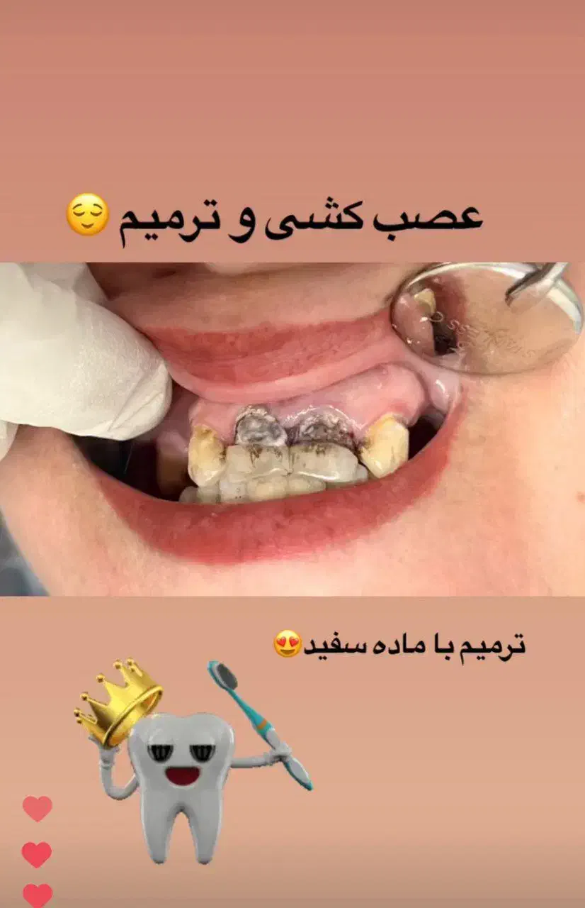 دندانپزشکی بزرگسال و اطفال|خدمات آرایشگری و زیبایی|لاهیجان, شیخ زاهد|دیوار