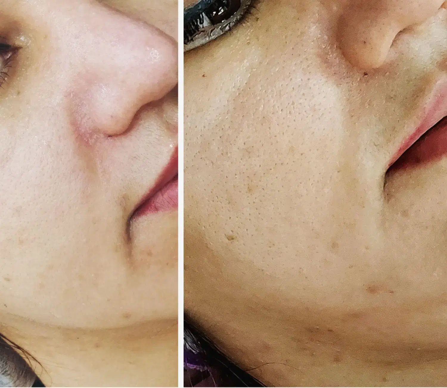 جشنواره یلدایی فشیال و پاکسازی پوست|خدمات آرایشگری و زیبایی|تهران, حکیمیه|دیوار