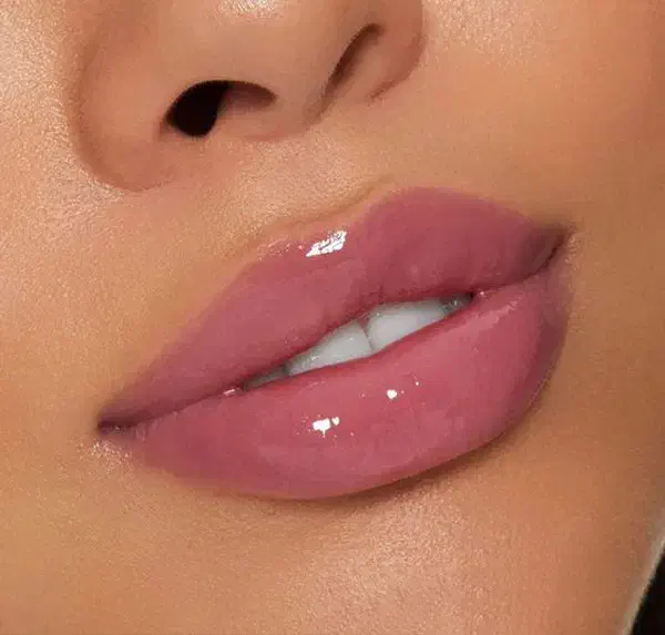 مدل ژل/فیلر لب|خدمات آرایشگری و زیبایی|تهران, قلهک|دیوار