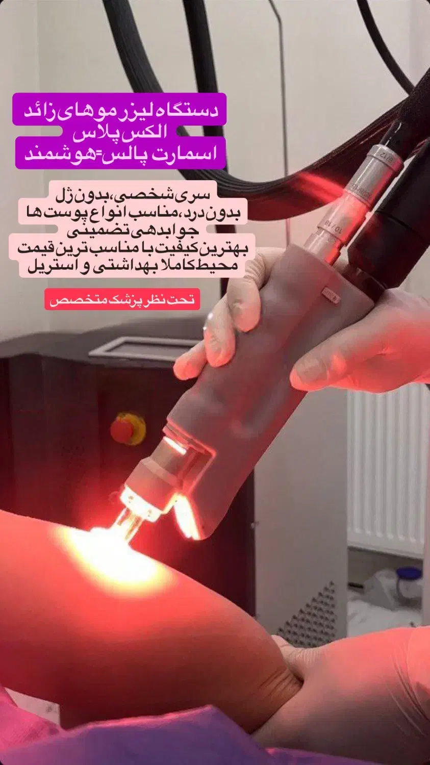 لیزر موهای زائد الکس پلاس (شاتی) بدون ژل/درمان لک|خدمات آرایشگری و زیبایی|رشت, گلسار|دیوار