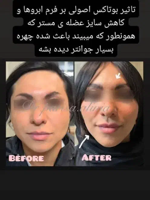 خدمات لیزر موهای زائد،.تزریق. ژل ،فیلر|خدمات آرایشگری و زیبایی|هشتگرد, شهرک ولیعصر (مصلی)|دیوار