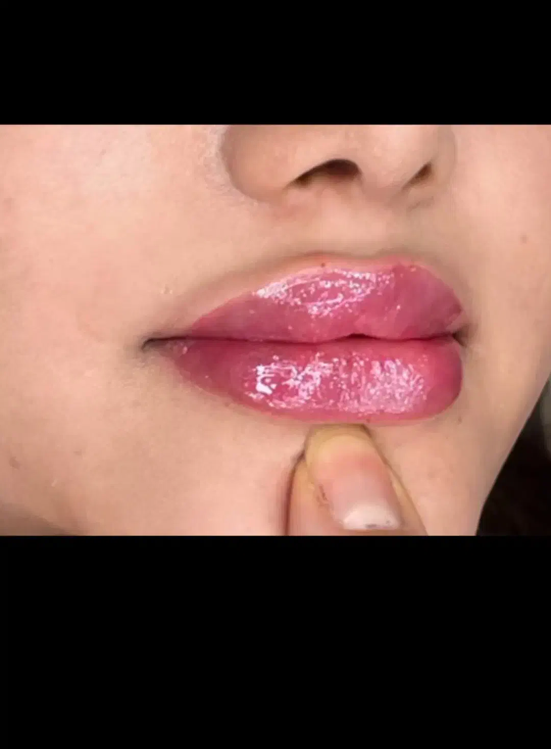 مدل ژل/فیلر لب|خدمات آرایشگری و زیبایی|تهران, قلهک|دیوار