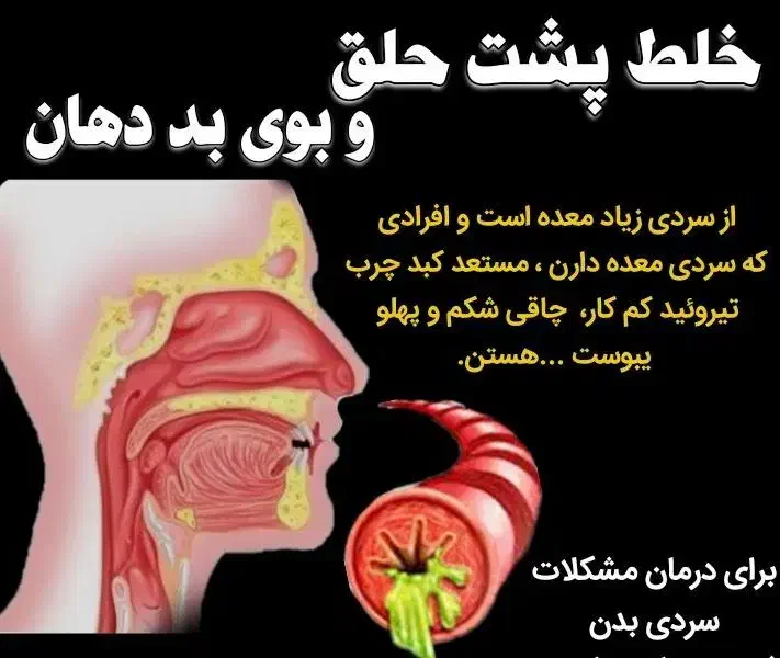 درمان بلغم/خلط پشت حلق/اگزما /اصلاح مزاج/گوارشی|آرایشی، بهداشتی، درمانی|فیروزکوه, |دیوار