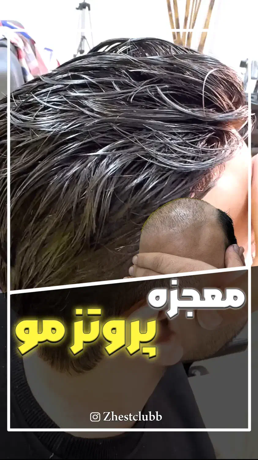 پروتز مو فروش و تعمیرات تخصصی|خدمات آرایشگری و زیبایی|تهران, تهرانپارس غربی|دیوار