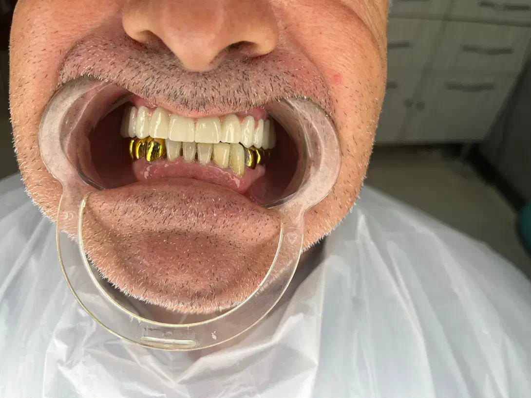 دندانپزشکی دنتال استار|خدمات آرایشگری و زیبایی|تهران, مینای جنوبی|دیوار