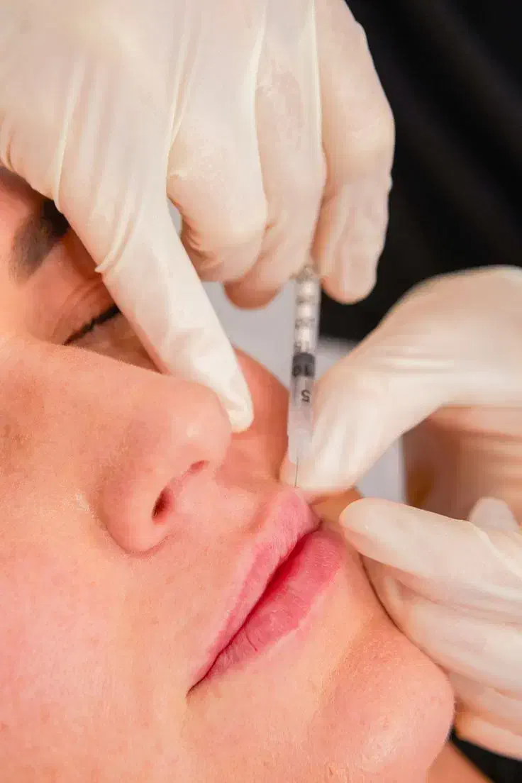 فیلر لب|خدمات آرایشگری و زیبایی|بروجرد, |دیوار