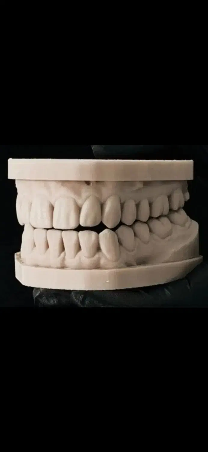 لابراتوار دندانسازی|استخدام درمانی، زیبایی، بهداشتی|تبریز, |دیوار