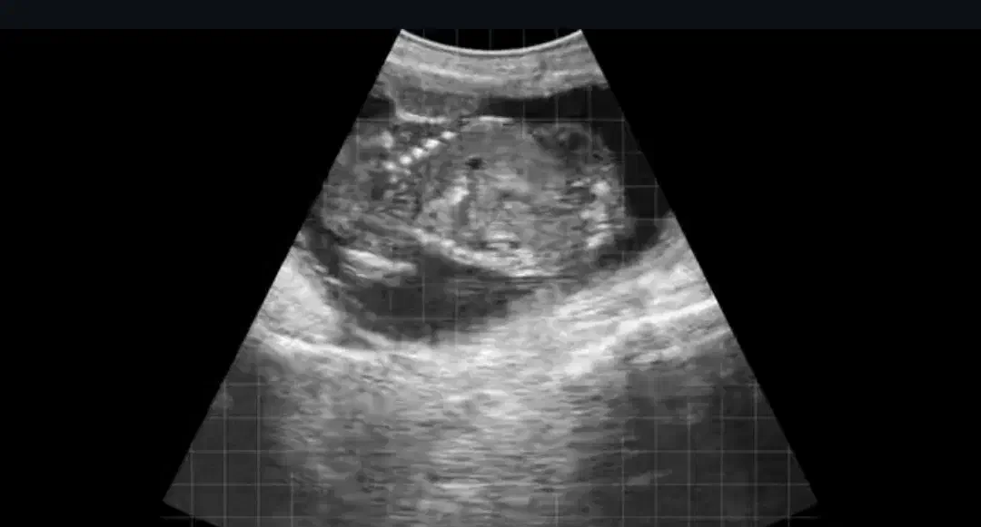 سونوگرافی انواع دام|حیوانات مزرعه|اصفهان, بوستان کوهستانی صفه|دیوار